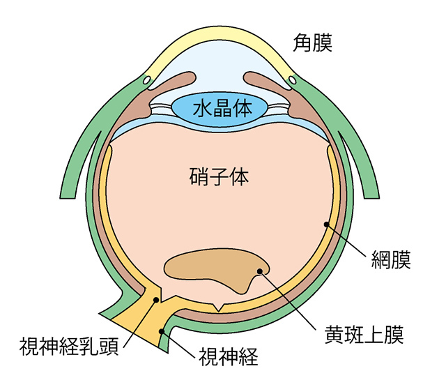 黄斑前膜とは