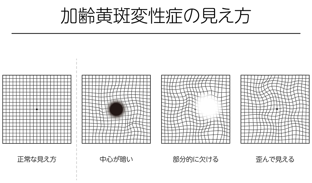 主な症状